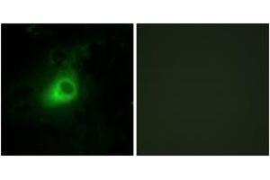 Immunofluorescence (IF) image for anti-G Protein-Coupled Receptor Kinase 6 (GRK6) (AA 10-59) antibody (ABIN2889479) (GRK6 anticorps  (AA 10-59))
