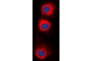 Immunofluorescent analysis of PPP2CA staining in HepG2 cells. (PPP2CA anticorps  (C-Term))
