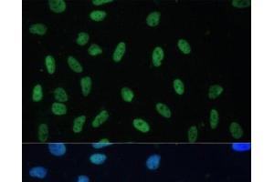 Immunofluorescence analysis of U-2 OS cells using HNRNPD Polyclonal Antibody at dilution of 1:100.