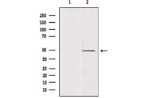 Western blot analysis of extracts from various samples, using ATP6V1C2 Antibody. (ATP6V1C2 anticorps  (Internal Region))