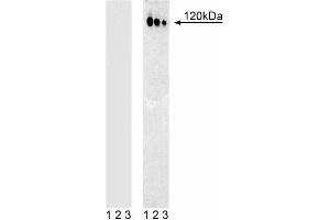 Western blot analysis of c-Cbl (pY774) in human T leukemia. (CBL anticorps  (pTyr774))
