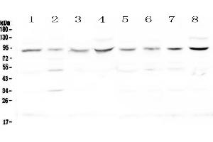 Western blot analysis of Cullin 4a using anti-Cullin 4a antibody .