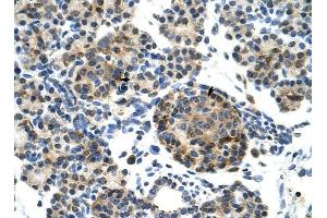 ZNF555 antibody was used for immunohistochemistry at a concentration of 4-8 ug/ml to stain Epithelial cells of pancreatic acinus (arrows) in Human Pancreas. (ZNF555 anticorps  (N-Term))