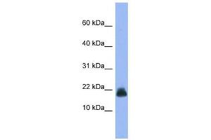 Western Blot showing Cst6 antibody used at a concentration of 1-2 ug/ml to detect its target protein.