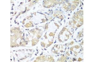 Immunohistochemistry of paraffin-embedded Human stomach using RPH3AL Polyclonal Antibody at dilution of 1:100 (40x lens). (RPH3AL anticorps)