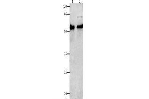 Western Blot analysis of Human liver cancer tissue and Hela cells using SMAD4 Polyclonal Antibody at dilution of 1:150 (SMAD4 anticorps)