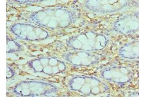 Immunohistochemistry of paraffin-embedded human epityphlon tissue using ABIN7171057 at dilution of 1:100 (SMARCC2 anticorps  (AA 300-650))