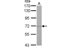 Western Blotting (WB) image for anti-Solute Carrier Family 4, Sodium Bicarbonate Cotransporter, Member 8 (SLC4A8) (N-Term) antibody (ABIN1494094) (SLC4A8 anticorps  (N-Term))