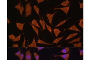 Immunofluorescence analysis of L929 cells using GLB1 Polyclonal Antibody at dilution of 1:100.