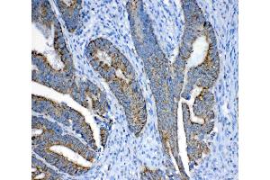 IHC analysis of FH using anti-FH antibody .