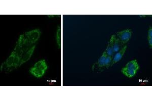 ICC/IF Image PCK2 antibody [C1C2], Internal detects PCK2 protein at mitochondria by immunofluorescent analysis. (PEPCK anticorps)