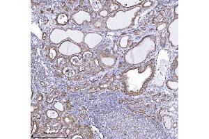 IHC analysis of DBN1 using anti-DBN1 antibody (ABIN7602637). (DBN1 anticorps  (AA 9-649))