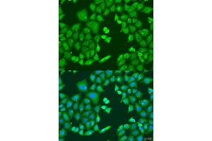 Immunofluorescence analysis of U2OS cells using CYP11B1 antibody (ABIN6292452) at dilution of 1:100. (CYP11B1 anticorps)