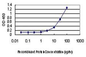 Detection limit for recombinant GST tagged PIM1 is approximately 0. (PIM1 anticorps  (AA 1-313))