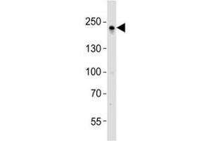 Western blot analysis of lysate from A431 cell line using ZO1 antibody diluted at 1:1000.