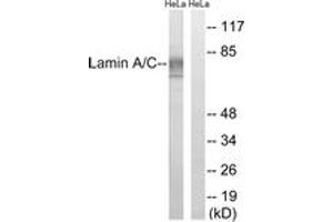 Western blot analysis of extracts from HeLa cells, treated with paclitaxel 1uM 24h, using Lamin A (Ab-22) Antibody. (Lamin A/C anticorps  (AA 2-51))