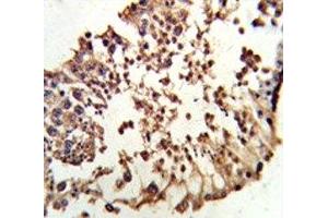 IHC analysis of FFPE human testis tissue stained with Retinoblastoma antibody (Retinoblastoma Protein (Rb) anticorps  (AA 858-886))