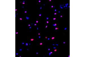 Immunofluorescence of paraffin embedded rat brain using ZNF682 (ABIN7076270) at dilution of 1:400 (400x lens) (ZNF682 anticorps)