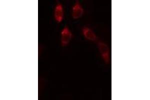 ABIN6272464 staining Hela by IF/ICC. (WDHD1 anticorps  (Internal Region))
