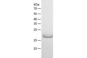 Interleukin 1 Family, Member 6 (IL1F6) (AA 1-160) protein (His-IF2DI Tag)