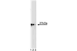 Western blot analysis of Drp1 on a HCT-8 cell lysate (Human colorectal adenocarcinoma, ATCC CCL-244). (Density Regulated Protein anticorps  (AA 19-201))