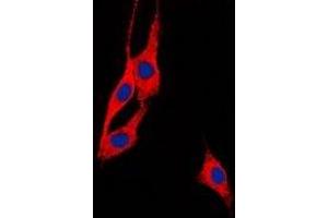 Immunofluorescent analysis of BEGAIN staining in Hela cells. (BEGAIN anticorps  (C-Term))