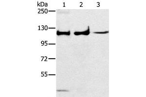 Western Blot analysis of Human fetal muscle tissue, A172 and K562 cell using ERK 5 Polyclonal Antibody at dilution of 1:250 (MAPK7 anticorps)