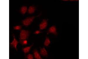 ABIN6275490 staining LOVO by IF/ICC. (ARHGAP17 anticorps  (Internal Region))