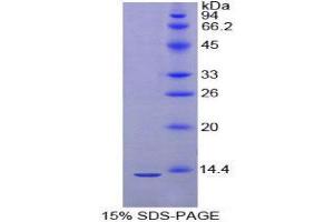 SDS-PAGE (SDS) image for Immunoglobulin lambda-Like Polypeptide 1 (IGLL1) (AA 112-206) protein (His tag) (ABIN2125242)