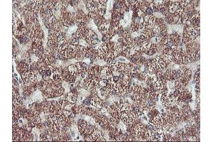 Immunohistochemical staining of paraffin-embedded Human liver tissue using anti-PECI mouse monoclonal antibody. (PECI/ECI2 anticorps)