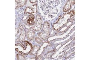 Immunohistochemical staining of human kidney with PRR13 polyclonal antibody  shows strong cytoplasmic positivity in renal tubules.