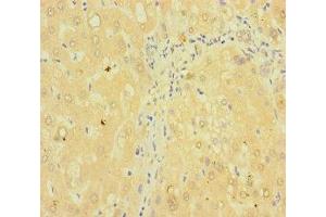 Immunohistochemistry of paraffin-embedded human liver tissue using ABIN7173003 at dilution of 1:100 (TMPRSS11B anticorps  (AA 201-416))