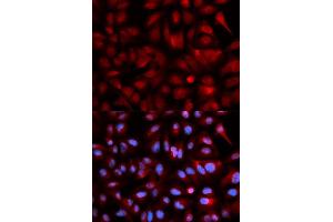 Immunofluorescence (IF) image for anti-Proteasome (Prosome, Macropain) Subunit, beta Type, 5 (PSMB5) antibody (ABIN1874372) (PSMB5 anticorps)