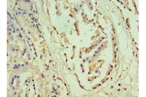Immunohistochemistry of paraffin-embedded human prostate tissue using ABIN7155843 at dilution of 1:100 (OTX2 anticorps  (AA 140-280))
