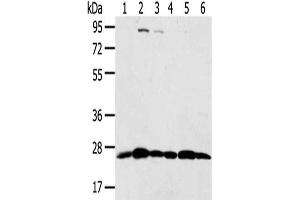 Gel: 8 % SDS-PAGE,Lysate: 40 μg,Lane 1-6: Hela cells, Raji cells, Jurkat cells, Human placenta tissue, A431 cells, 231 cells,Primary antibody: ABIN7192036(PSMB8 Antibody) at dilution 1/350 dilution,Secondary antibody: Goat anti rabbit IgG at 1/8000 dilution,Exposure time: 10 seconds (PSMB8 anticorps)