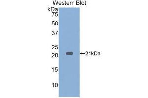 WB of Protein Standard: different control antibodies against Highly purified E. (TNF alpha Kit ELISA)