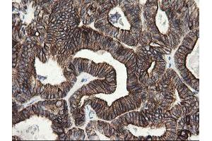 Image no. 7 for anti-Src-like-adaptor 2 (SLA2) antibody (ABIN1500949) (SLAP2 anticorps)