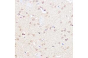 Immunohistochemistry of paraffin-embedded rat brain using BRD2 Rabbit pAb (ABIN7265939) at dilution of 1:50 (40x lens). (BRD2 anticorps  (AA 1-100))