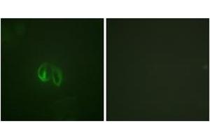 Immunofluorescence analysis of HepG2 cells, using IL-10R alpha (Ab-496) Antibody. (IL-10RA anticorps  (AA 462-511))