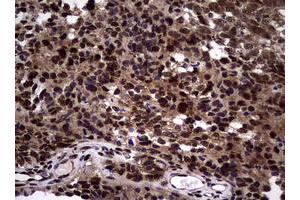 Image no. 10 for anti-Nibrin (NBN) (AA 183-460) antibody (ABIN1491058)