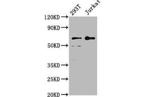 Western Blot Positive WB detected in: 293T whole cell lysate, Jurkat whole cell lysate All lanes: LILRB2 antibody at 4 μg/mL Secondary Goat polyclonal to rabbit IgG at 1/50000 dilution Predicted band size: 66, 65, 56, 52 kDa Observed band size: 66 kDa (LILRB2 anticorps  (AA 406-563))