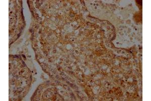 IHC image of ABIN7127862 diluted at 1:100 and staining in paraffin-embedded human placenta tissue performed on a Leica BondTM system.