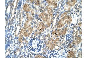 PARL antibody was used for immunohistochemistry at a concentration of 4-8 ug/ml. (PARL anticorps  (N-Term))