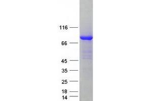 Validation with Western Blot