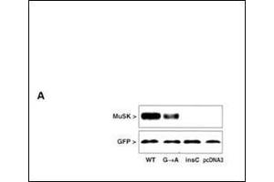 MuSK protein expression in extracts of COS cells after transfection with MuSK mutated and GFP constructs. (MUSK anticorps  (N-Term))