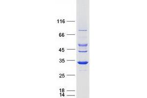 Validation with Western Blot (SDR9C7 Protein (Myc-DYKDDDDK Tag))