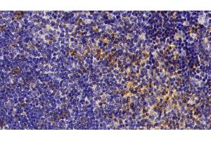 Detection of a1AT in Mouse Spleen Tissue using Polyclonal Antibody to Alpha-1-Antitrypsin (a1AT)