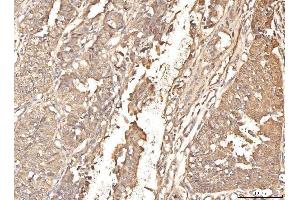 IHC analysis of BHMT using anti-BHMT antibody (ABIN7599940). (BHMT anticorps  (AA 13-386))