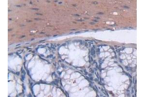 Detection of TSK in Mouse Small intestine Tissue using Polyclonal Antibody to Tsukushin (TSK)