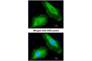 ICC/IF Image Immunofluorescence analysis of paraformaldehyde-fixed HeLa, using DDX3Y, antibody at 1:200 dilution.
